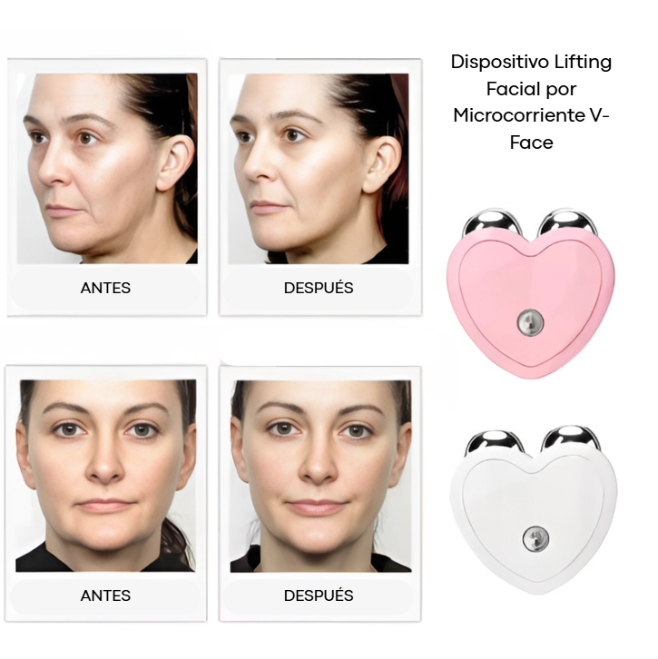 Dispositivo Lifting Facial por Microcorriente V-Face